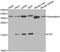 Fragile Histidine Triad Diadenosine Triphosphatase antibody, A1196, ABclonal Technology, Western Blot image 