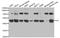 Integrin Linked Kinase antibody, STJ24198, St John