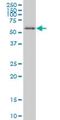 E3 ubiquitin-protein ligase UBR4 antibody, H00023352-M01, Novus Biologicals, Western Blot image 