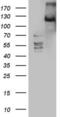 Serine/threonine-protein kinase LATS2 antibody, LS-C790272, Lifespan Biosciences, Western Blot image 