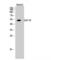 Glucagon-like peptide 1 receptor antibody, LS-C383709, Lifespan Biosciences, Western Blot image 