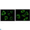 Keratin 5 antibody, LS-C812437, Lifespan Biosciences, Western Blot image 