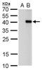 Paired Like Homeodomain 2 antibody, GTX129141, GeneTex, Western Blot image 