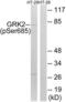 G Protein-Coupled Receptor Kinase 2 antibody, LS-C199027, Lifespan Biosciences, Western Blot image 