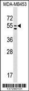 Phosphatidylserine Synthase 1 antibody, 58-967, ProSci, Western Blot image 