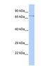 F-Box And WD Repeat Domain Containing 8 antibody, NBP1-56338, Novus Biologicals, Western Blot image 