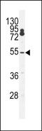 Cleavage And Polyadenylation Specific Factor 7 antibody, PA5-71643, Invitrogen Antibodies, Western Blot image 