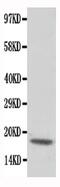 Troponin C1, Slow Skeletal And Cardiac Type antibody, PA5-80171, Invitrogen Antibodies, Western Blot image 