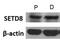 Lysine Methyltransferase 5A antibody, NBP1-91269, Novus Biologicals, Western Blot image 