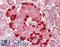 TSPY Like 2 antibody, LS-B11181, Lifespan Biosciences, Immunohistochemistry paraffin image 