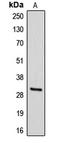 Iodothyronine Deiodinase 3 antibody, LS-C352116, Lifespan Biosciences, Western Blot image 