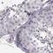 Zinc Finger Protein 185 With LIM Domain antibody, NBP1-86192, Novus Biologicals, Immunohistochemistry paraffin image 