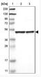 Adipocyte Plasma Membrane Associated Protein antibody, NBP1-89927, Novus Biologicals, Western Blot image 