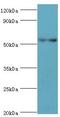 Patatin Like Phospholipase Domain Containing 3 antibody, LS-C380154, Lifespan Biosciences, Western Blot image 