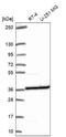 Ribosomal Protein L5 antibody, NBP2-68710, Novus Biologicals, Western Blot image 