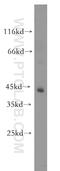 Tubulin Tyrosine Ligase antibody, 13618-1-AP, Proteintech Group, Western Blot image 