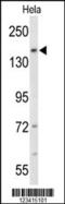 Fibronectin type III domain-containing protein 3B antibody, 63-633, ProSci, Western Blot image 