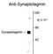 Synaptotagmin 1 antibody, GTX82585, GeneTex, Western Blot image 