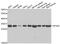 Ribosomal Protein S4 X-Linked antibody, abx005162, Abbexa, Western Blot image 