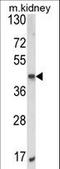 AlkB Homolog 3, Alpha-Ketoglutaratedependent Dioxygenase antibody, LS-C156282, Lifespan Biosciences, Western Blot image 