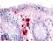Macrophage Stimulating 1 Receptor antibody, LS-A7187, Lifespan Biosciences, Immunohistochemistry frozen image 
