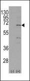 Nuclear Receptor Subfamily 4 Group A Member 1 antibody, LS-C100016, Lifespan Biosciences, Western Blot image 