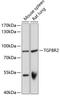 Transforming Growth Factor Beta Receptor 2 antibody, 14-143, ProSci, Western Blot image 