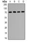 Peroxisomal Biogenesis Factor 5 antibody, orb381950, Biorbyt, Western Blot image 
