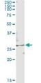 Testis Specific Serine Kinase 3 antibody, H00081629-M03, Novus Biologicals, Immunoprecipitation image 