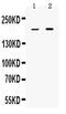 KIAA0568 antibody, PA5-79856, Invitrogen Antibodies, Western Blot image 