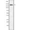 Sodium Voltage-Gated Channel Alpha Subunit 9 antibody, abx217565, Abbexa, Western Blot image 