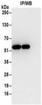 Tryptophanyl-TRNA Synthetase antibody, NBP2-32185, Novus Biologicals, Immunoprecipitation image 