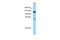 Caprin Family Member 2 antibody, A08955, Boster Biological Technology, Western Blot image 