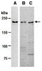 Tet Methylcytosine Dioxygenase 2 antibody, orb67236, Biorbyt, Western Blot image 