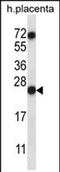 Ribonuclease A Family Member 8 antibody, PA5-71813, Invitrogen Antibodies, Western Blot image 