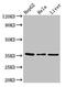 Sprouty RTK Signaling Antagonist 1 antibody, CSB-PA022621LA01HU, Cusabio, Western Blot image 