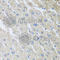 Mixed Lineage Kinase Domain Like Pseudokinase antibody, A5579, ABclonal Technology, Immunohistochemistry paraffin image 