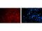 Paired Box 6 antibody, M00273, Boster Biological Technology, Immunohistochemistry paraffin image 