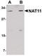 N(Alpha)-Acetyltransferase 40, NatD Catalytic Subunit antibody, PA5-20882, Invitrogen Antibodies, Western Blot image 