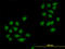 SMAD Family Member 4 antibody, LS-C197636, Lifespan Biosciences, Immunofluorescence image 