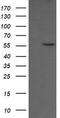 Chaperonin Containing TCP1 Subunit 8 Like 2 antibody, CF505336, Origene, Western Blot image 