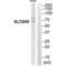 Solute Carrier Family 6 Member 8 antibody, SPC-1333D-A655, StressMarq, Western Blot image 