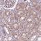 Rho Family GTPase 3 antibody, PA5-63863, Invitrogen Antibodies, Immunohistochemistry frozen image 