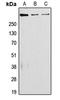 Laminin Subunit Alpha 5 antibody, GTX55867, GeneTex, Western Blot image 