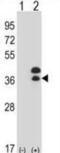 Distal-Less Homeobox 5 antibody, abx027999, Abbexa, Immunohistochemistry frozen image 