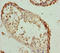 Rac GTPase Activating Protein 1 antibody, LS-C676356, Lifespan Biosciences, Immunohistochemistry paraffin image 