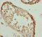 Rac GTPase-activating protein 1 antibody, LS-C676356, Lifespan Biosciences, Immunohistochemistry paraffin image 