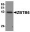 Zinc Finger And BTB Domain Containing 6 antibody, TA319829, Origene, Western Blot image 