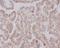 Kinesin Family Member C1 antibody, M05325, Boster Biological Technology, Immunohistochemistry frozen image 