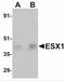ESX Homeobox 1 antibody, NBP1-77114, Novus Biologicals, Western Blot image 